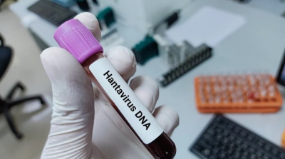 Число подтвержденных случаев хантавируса возросло до 12, зарегистрировано три случая смерти
