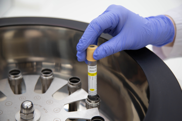 Врач Каприн: риск заболеть раком существует в любой точке мира